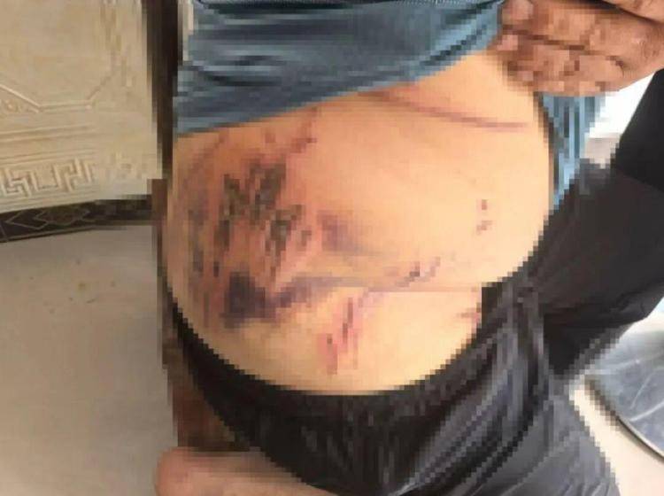 湖北鹤峰县疑再现老虎踪迹,村民家猪遭袭,玉米地发现脚印,此前男子自称干农活时被抓伤,当地回应